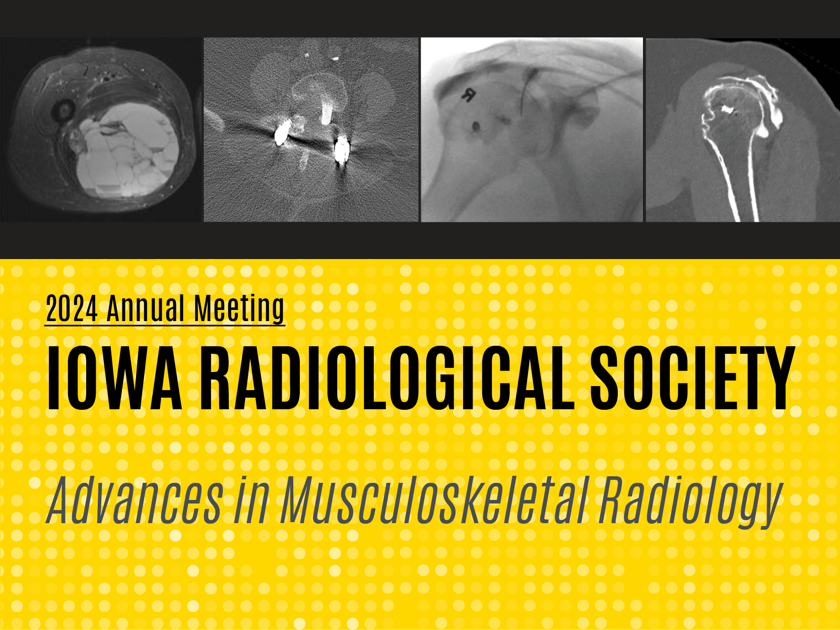 Iowa Radiological Society 2024 Annual Meeting: Advances in Musculoskeletal Radiology Banner